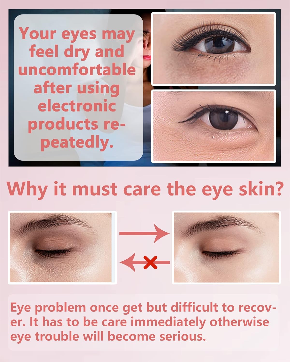 Under Eye Patches (60Pcs) - Update Eye Mask Rose Extract, Eye Treatment Mask, Under Eye Bag Treatment, Eye Mask for Puffy Eyes, Anti-Aging, Anti-Wrinkle and Fine Lines,Under eye Dark Circles for Women