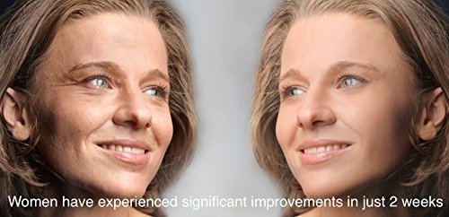On In Beauty System