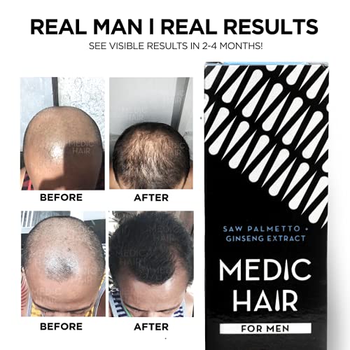 FOR MEN 90ml, 3.04 fl oz, Contains Saw Palmetto and Ginseng Extract, DHT Blocking, Natural, Healthy Hair Growth