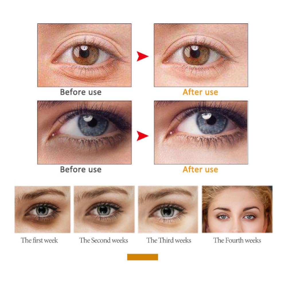 Peptide Under Eye Roller Serum With Roller Balls For Dark Circles And Puffiness | Massage Ball Cream for Fine Lines and Wrinkles | Hydrates Brightens Under Eye Area Restores Skin Firmness (PEPTIDE)