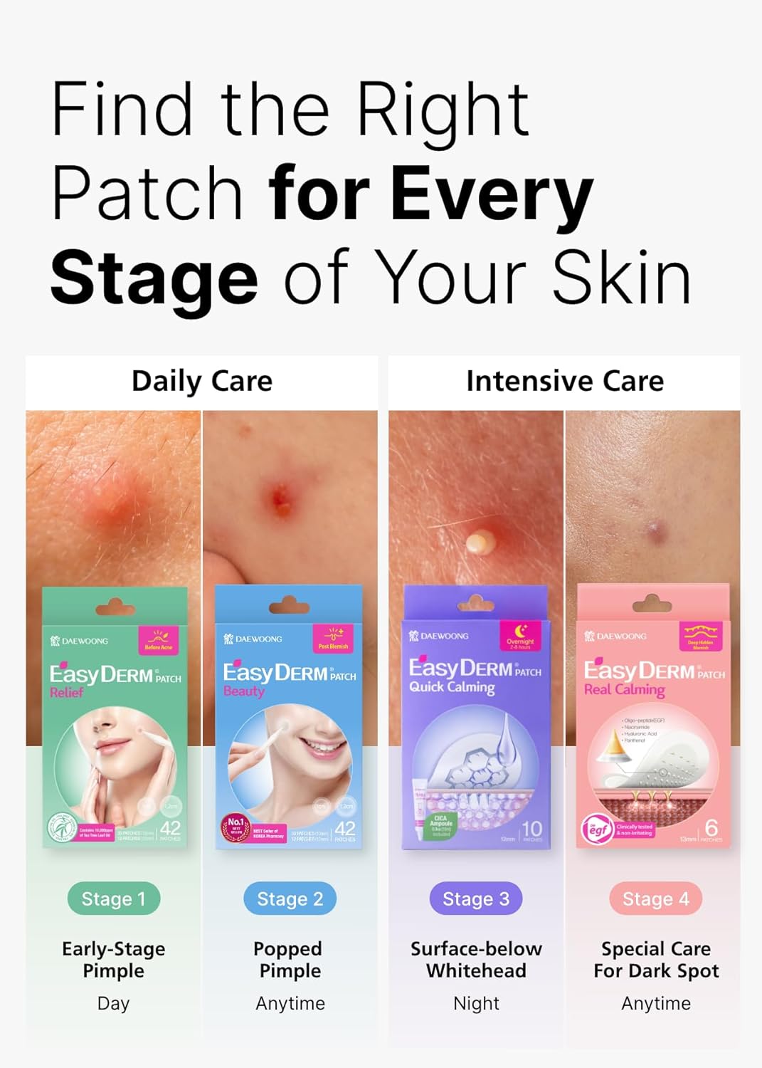 EasyDerm Multi-Step Pimple Patch Set – 4-Type Korean Pimple Patches + Free 2-in-1 Dual-Tip Extractor for Complete Skincare