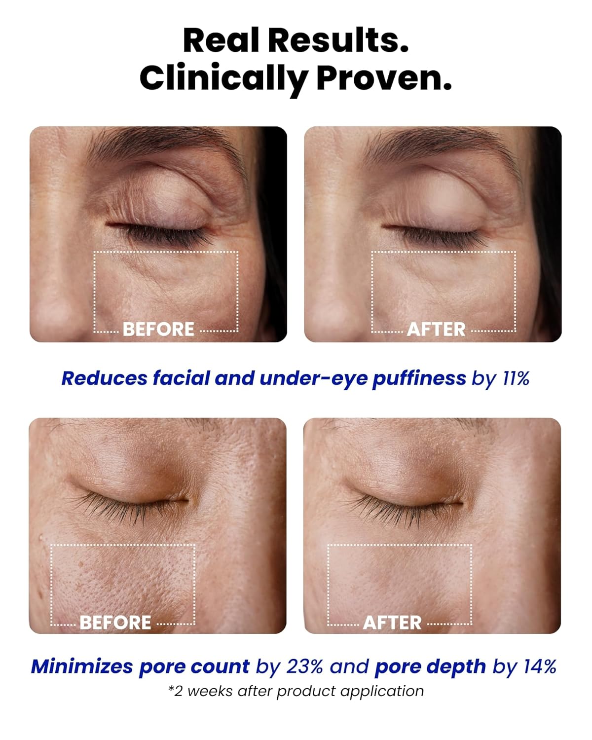 Ice Roll Serum | Cooling & Hydrating Roll-On Serum for Face, Puffy Eyes, Tannin & Panthenol for Pore Minimizing, Soothing, Facial Roller for Depuffing, Under Eye Bag Treatment | Korean Skin Care