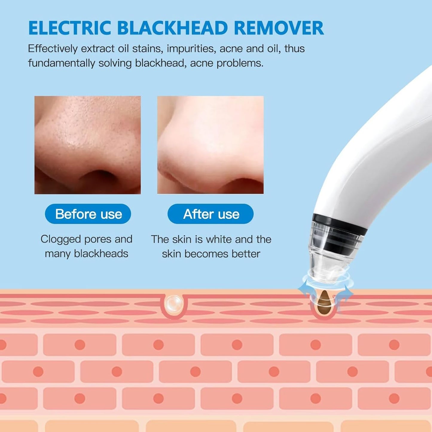 2025 New ABS Electric Blackhead Remover Cleaner Face Diamond Pore Vacuum Suction White Heads