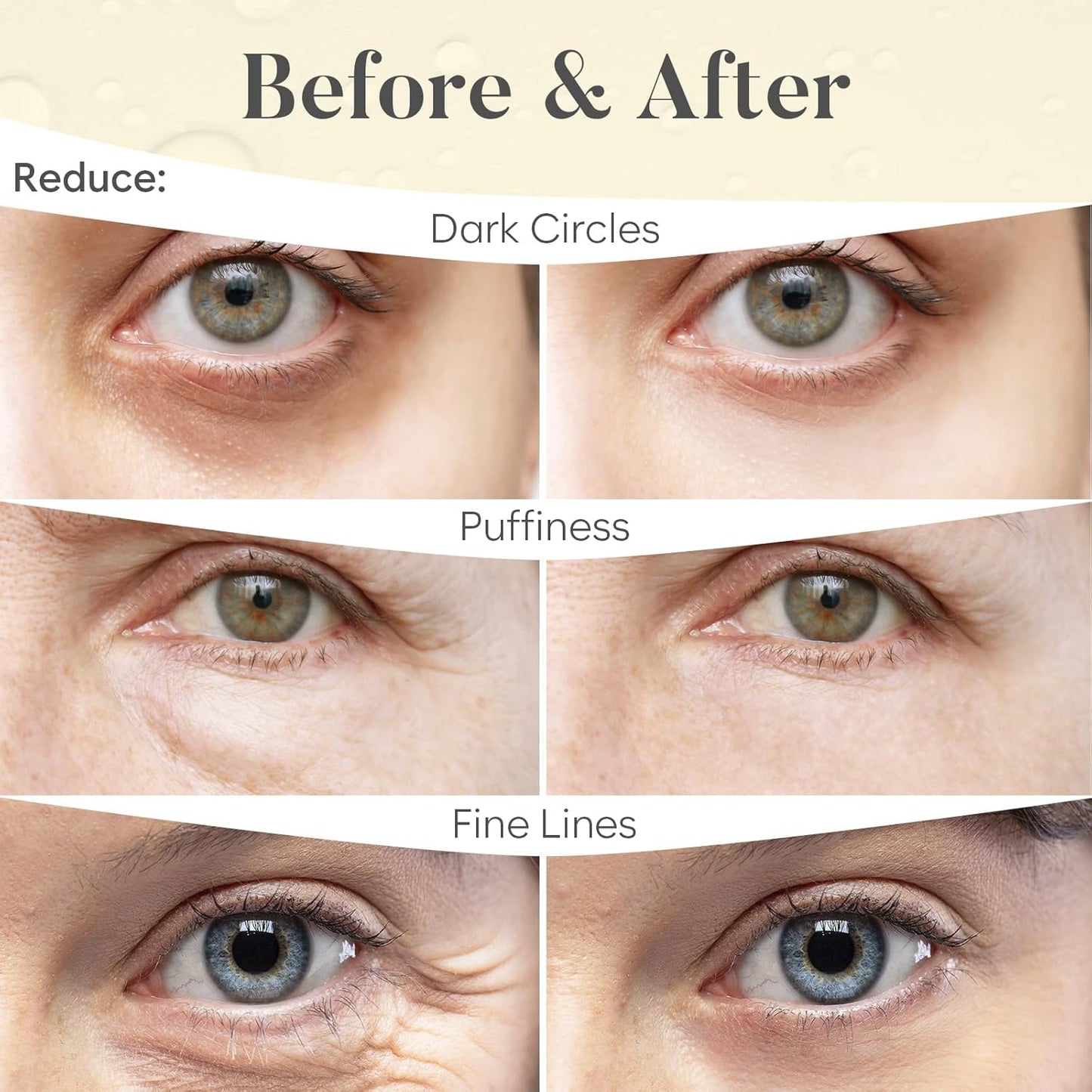 24K Gold Eye Mask (30 Pairs) | Eye Masks with Niacinamide & Hyaluronic Acid | Under Eye Patches for Dark Circles | Under Eye Patches for Puffy Eyes | Eye Care