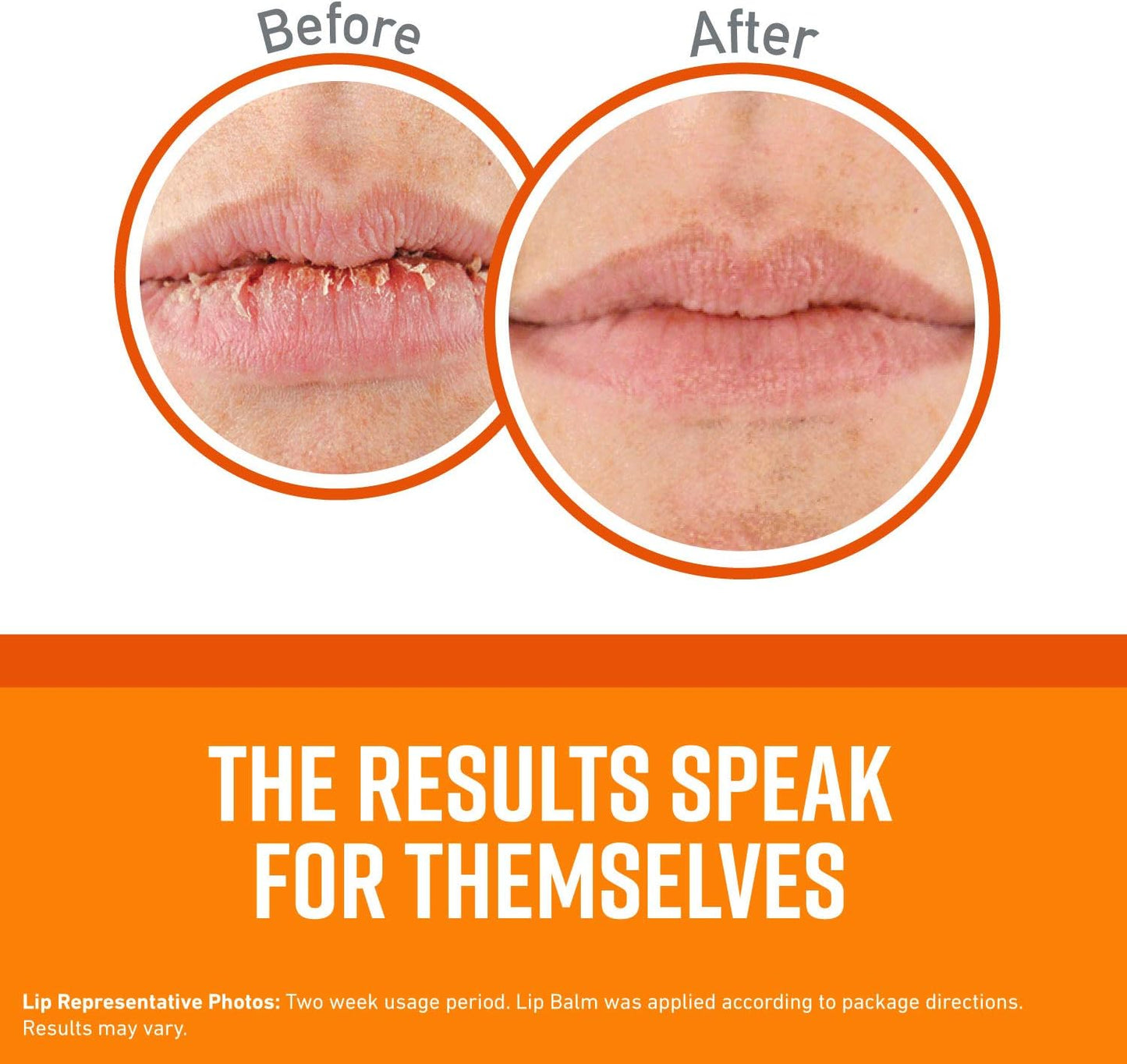 O'Keeffe's Unscented Lip Repair Lip Balm for Dry, Cracked Lips, Stick, (Pack of 9)