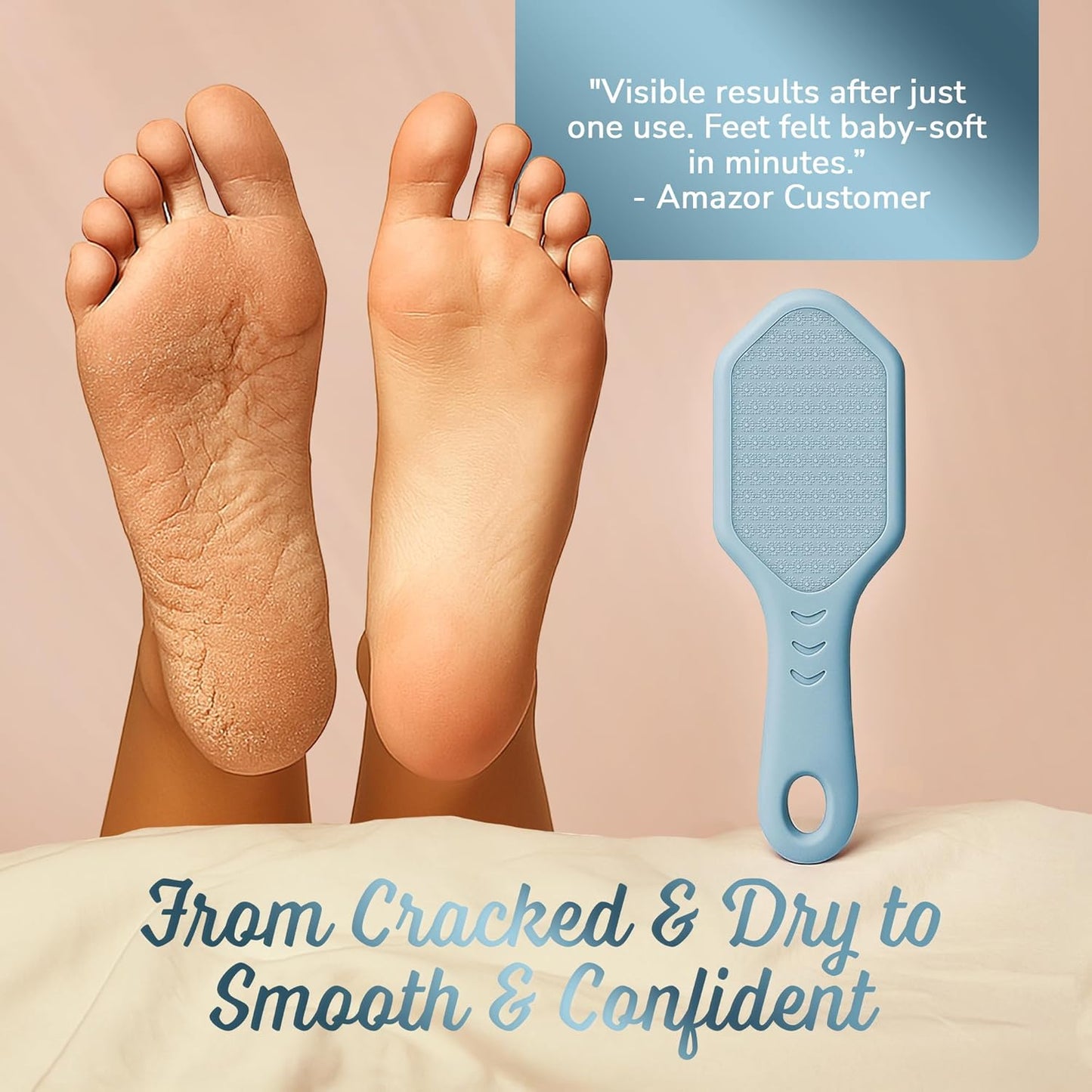 Silicone Foot Callus Remover - Nano Glass Foot File for Dead Skin and Cracked Heels - Callus Remover for Feet & Hard Skin - Ergonomic Foot Scrubber & Exfoliator for Soft, Smooth Feet - Blue