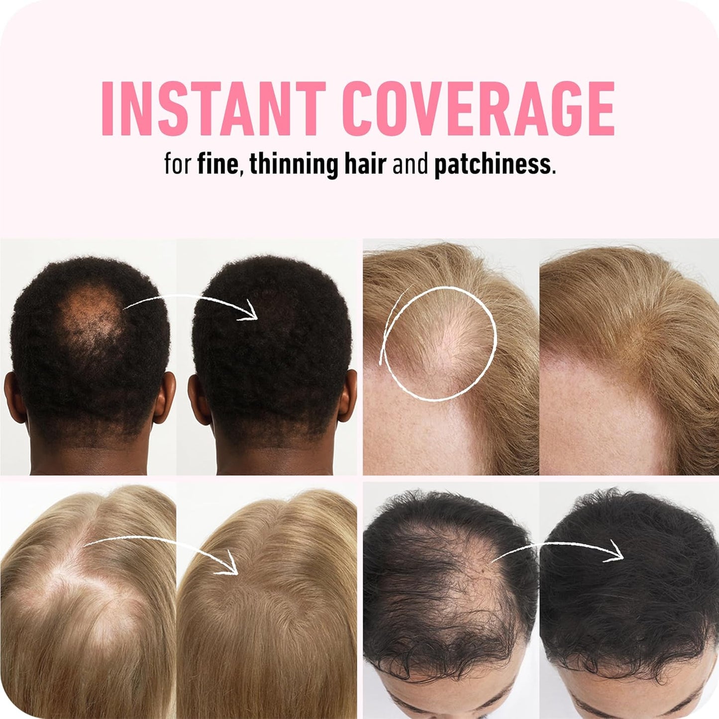 BOLDIFY Hair Fibers (12g) - Fill In Thinning and Fine Hair for an Instantly Fuller, Thicker Look - 14 Shades for Women & Men - White
