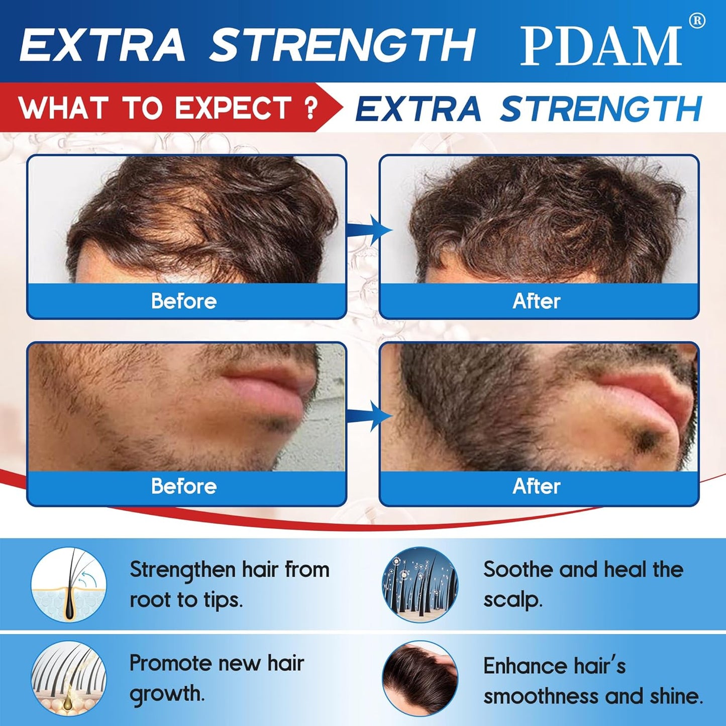 Minoxidil for Men Hair Growth Spray - 5% Topical Minoxidil for Hair and Beard Growth, Extra Strength Hair Regrowth Treatment for Hair Loss & Thinning Hair, 2 Fl Oz (60ml) *1