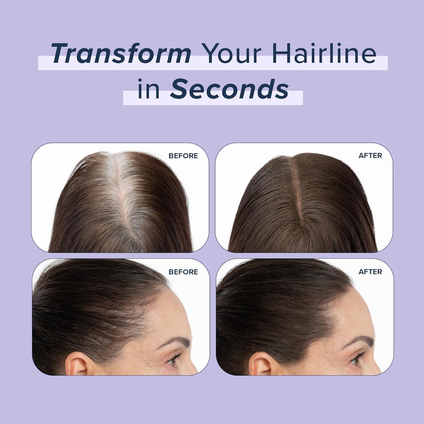 TRUHAIR Root & Scalp Cover Up Pressed Powder Compact Refill, Waterproof, Weightless Hair Coverage & Bald Spot Concealing, Root Touch Up Hair Color for Gray Coverage & Thinning Areas, 0.35 Oz (Gray)